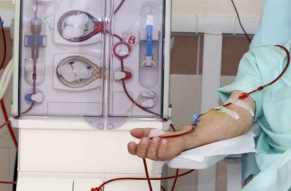 دیالیز چیست و چگونه انجام می شود؟